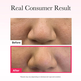 ARENCIA serum residue after removal illustrating absorbed, non-greasy benefit