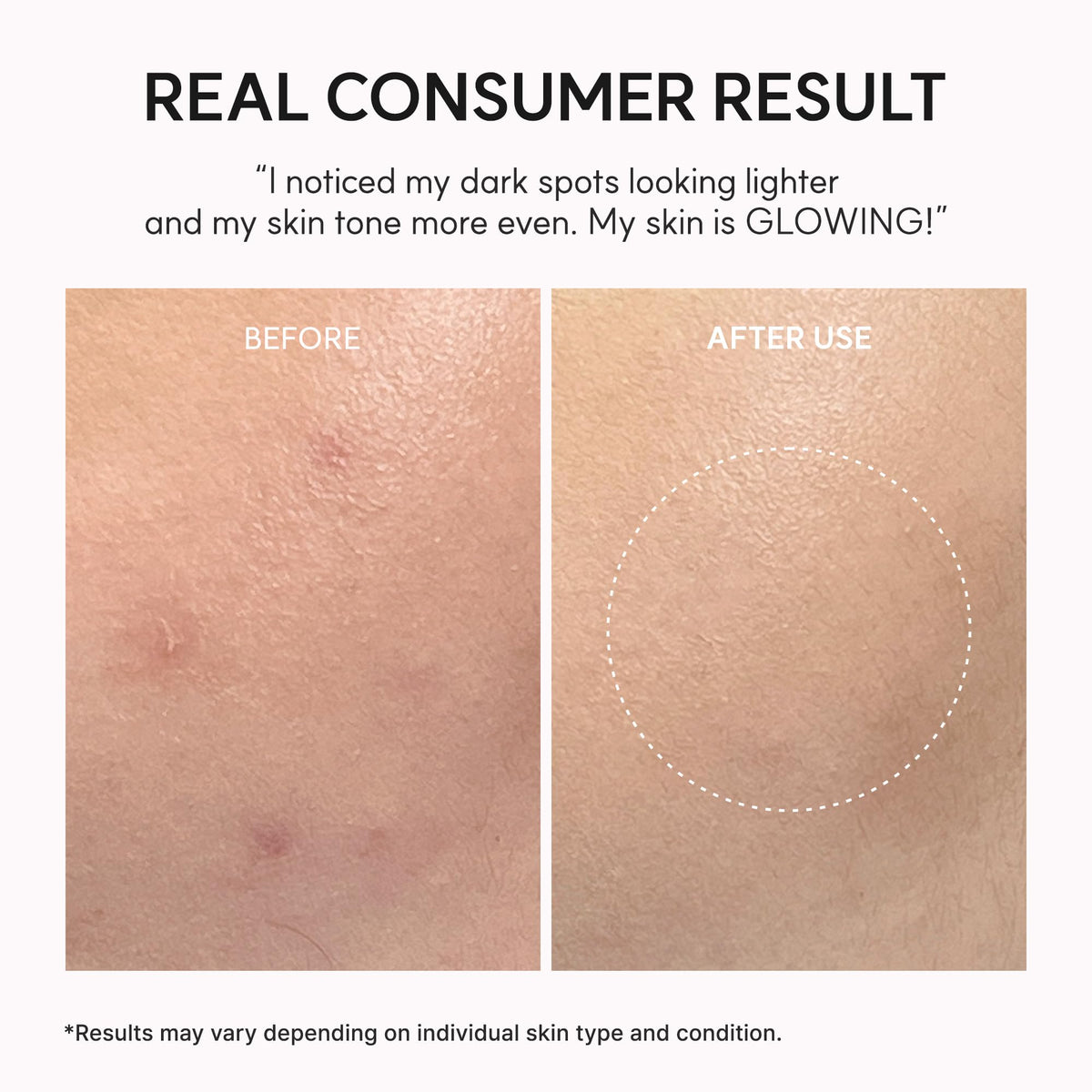 ARENCIA layered under moisturizer illustrating compatibility with routines