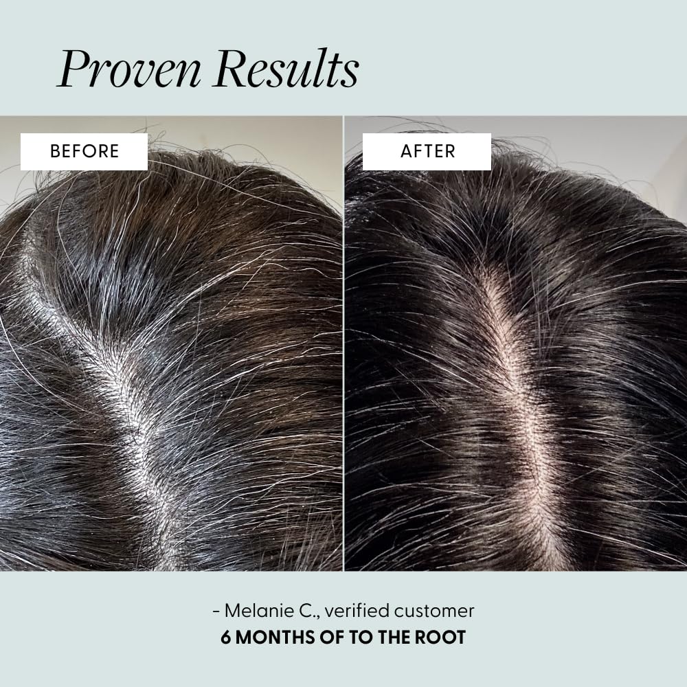 Arey serum texture on scalp showing fast-absorbing, non-greasy finish