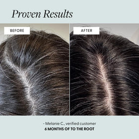 Arey serum texture on scalp showing fast-absorbing, non-greasy finish