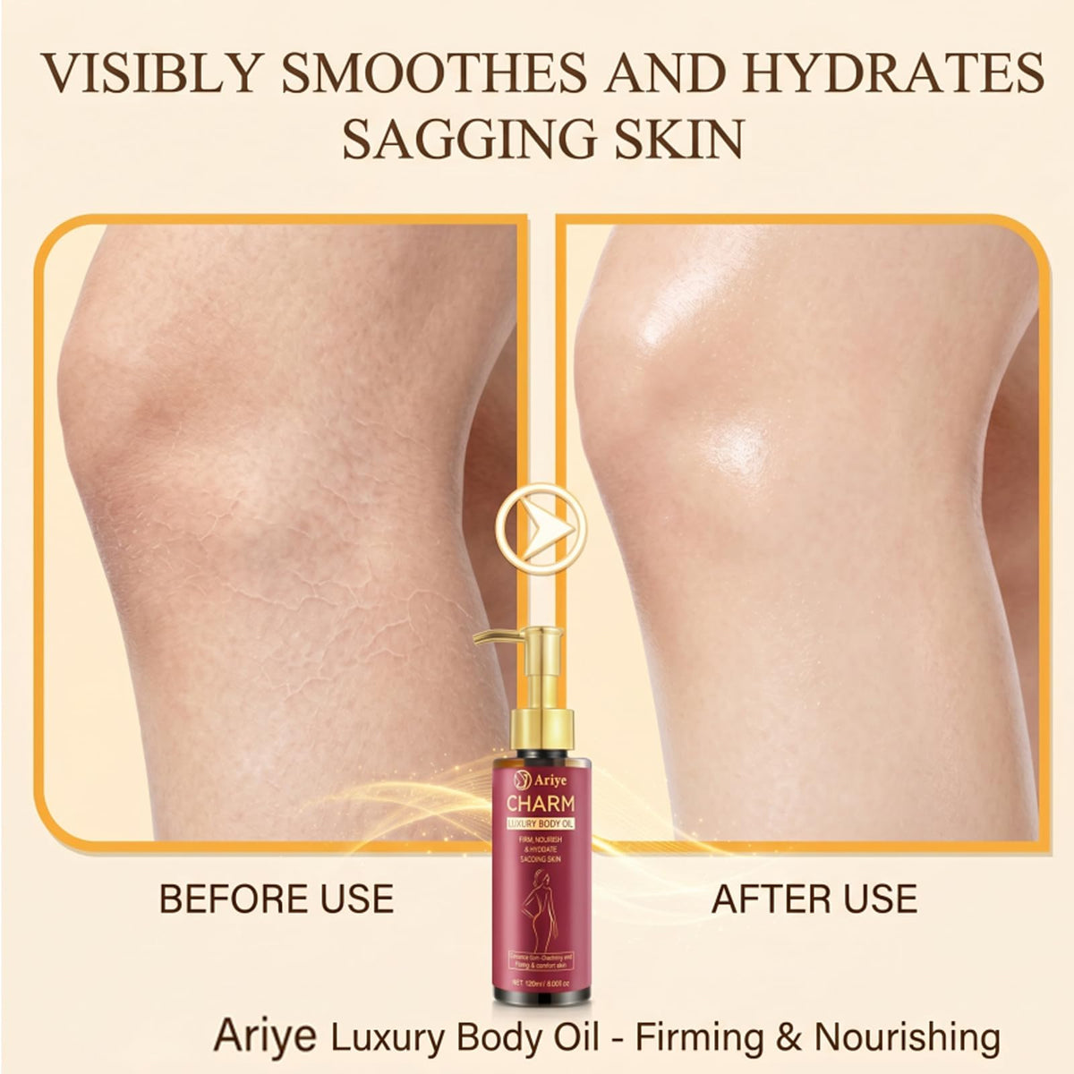 ARIYE arm before and after photo showing smoother, firmer-looking skin