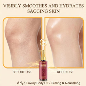 ARIYE arm before and after photo showing smoother, firmer-looking skin