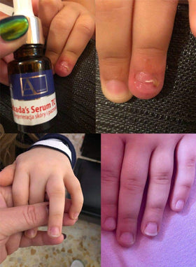ARKADA serum inside travel kit showing spill-proof convenience