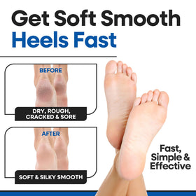 ARMSTRONG AMERICA inside view of lotion-lined heel pad for targeted moisturizing
