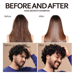 Artimore rosemary and biotin ingredient focus highlighting natural actives for nourishment