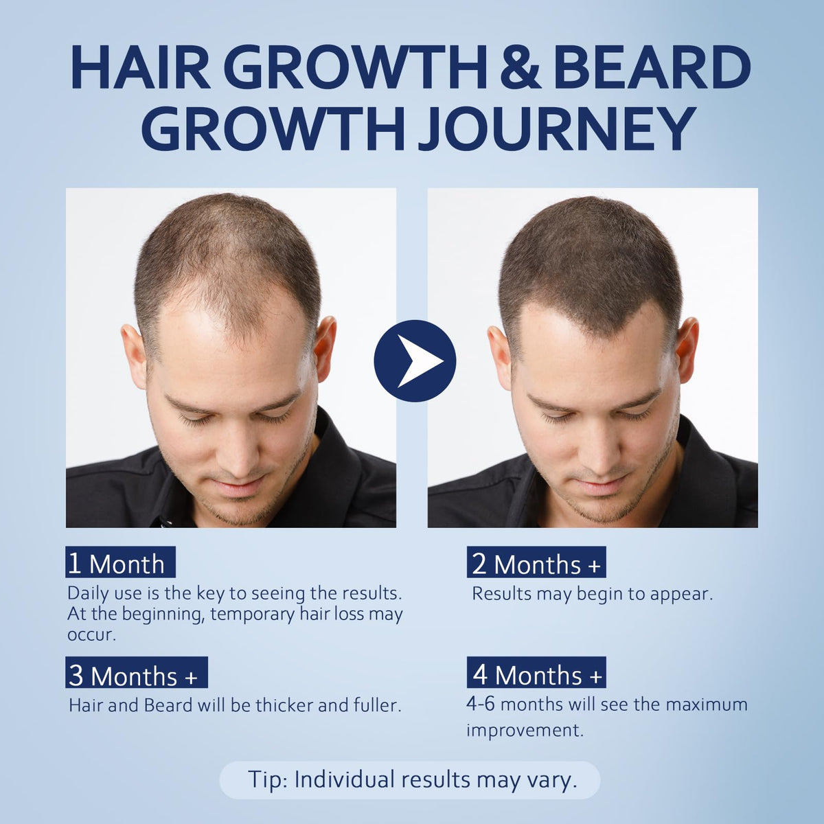 Artimore being applied to scalp demonstrating target application and daily routine benefit