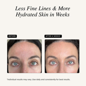 Asterwood hyaluronic molecule graphic illustrating hydration and moisture retention
