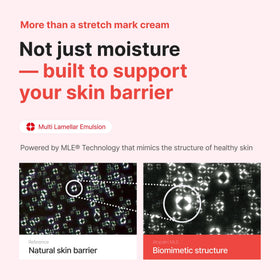 ATOPALM applied to pregnant belly, gentle application improves skin suppleness