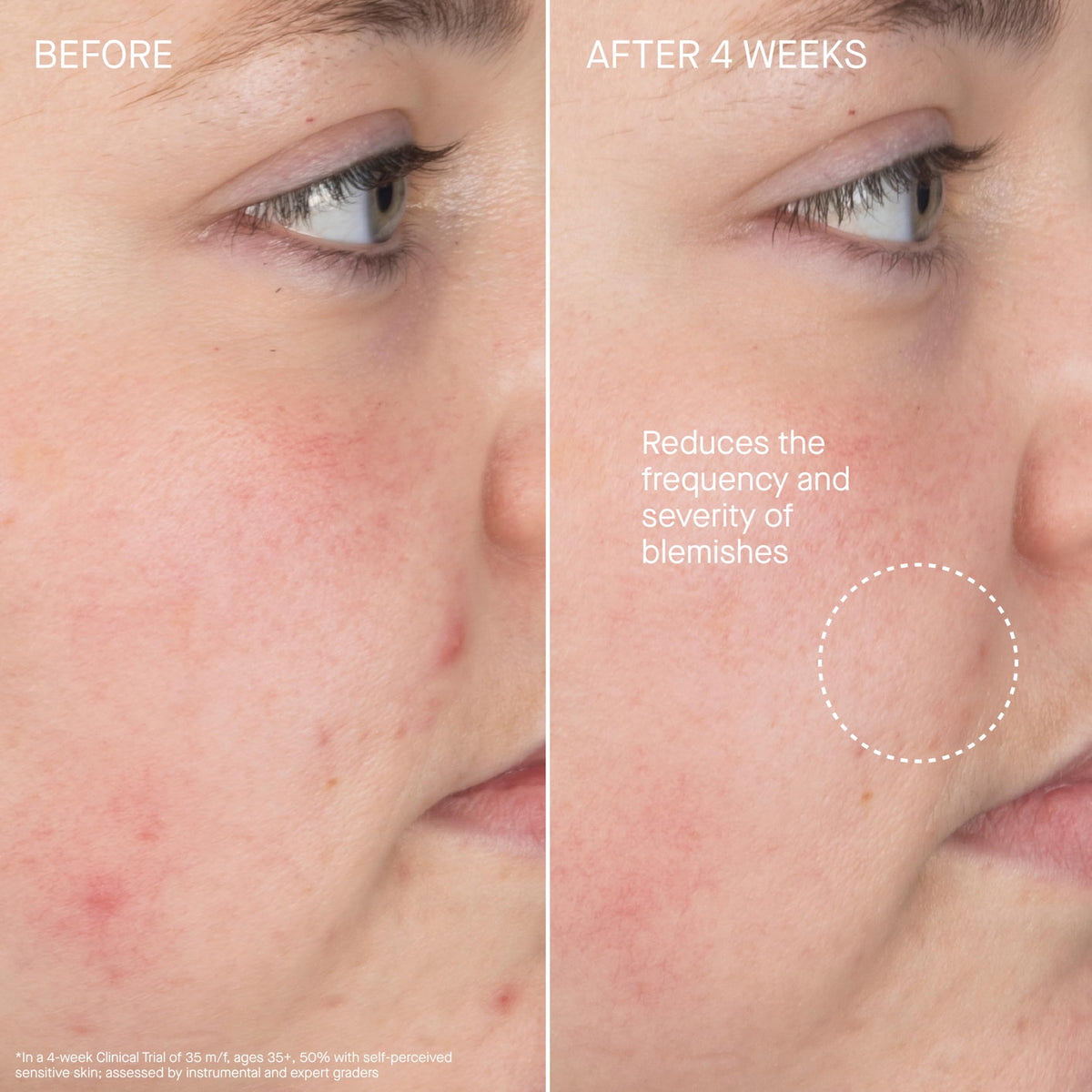 Augustinus Bader cleanser cream-to-foam texture close-up demonstrating gentle lather