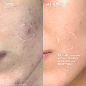 Augustinus Bader cream on fingers illustrating smooth spreadability and nourishment