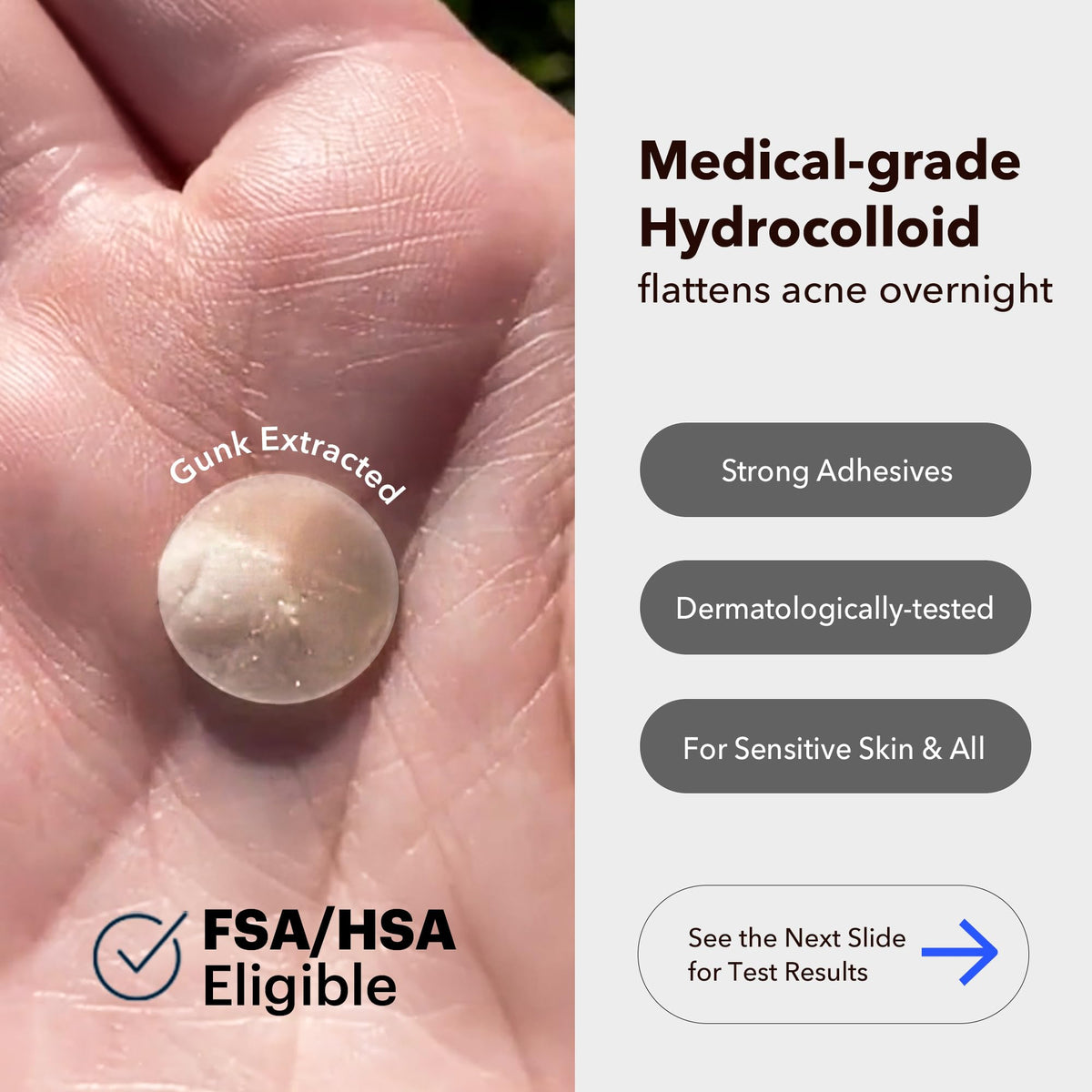 AVARELLE close-up of hydrocolloid texture highlighting thinness