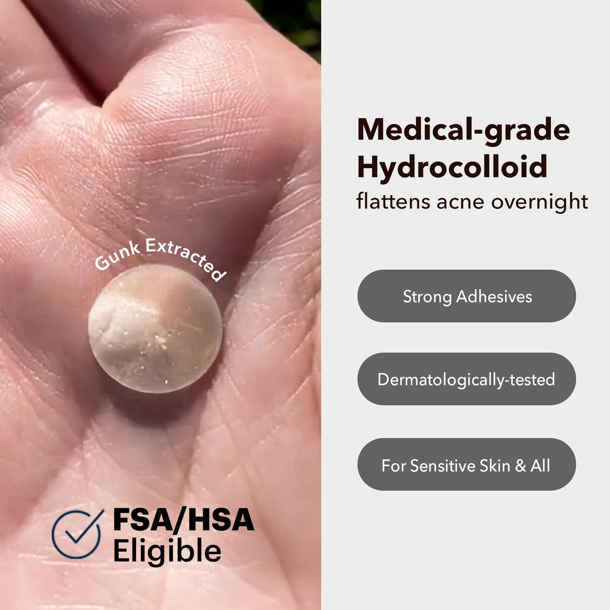 AVARELLE patch applied on cheek demonstrating discreet blemish coverage