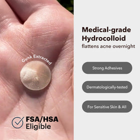 AVARELLE patch applied on cheek demonstrating discreet blemish coverage