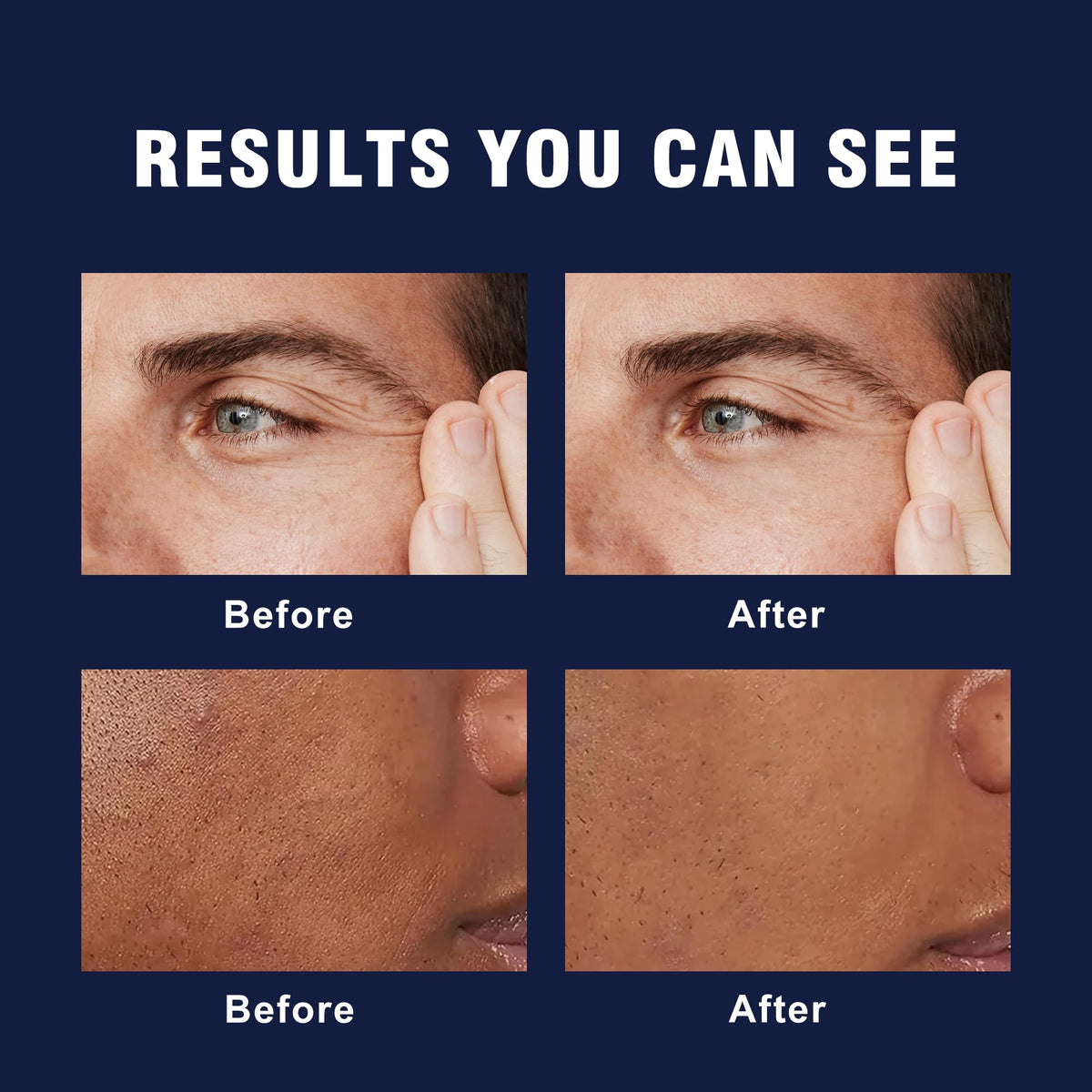 AVITAPURE cream on hand demonstrating smooth application and immediate hydration