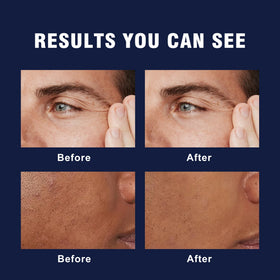 AVITAPURE cream on hand demonstrating smooth application and immediate hydration