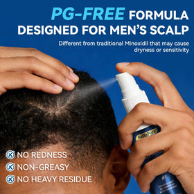 AVITAPURE ingredients with biotin and rosemary oil for scalp nourishment