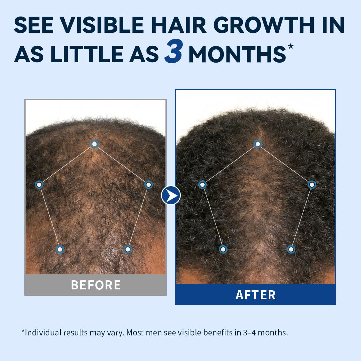 AVITAPURE formula droplet on skin highlighting fast-absorbing texture