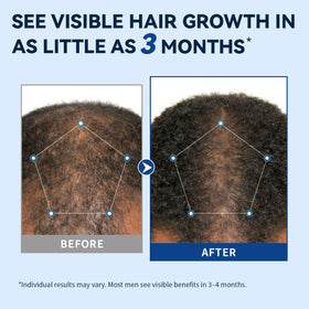 AVITAPURE formula droplet on skin highlighting fast-absorbing texture