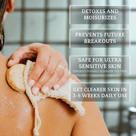 Bacne Bar ingredient lineup with aloe and oils displaying natural formulation benefit