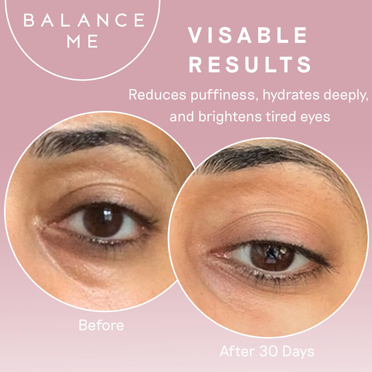 Balance Me applying cream under eye showing reduced puffiness benefit