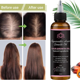 BALPPRD oil texture on dropper highlighting lightweight feel and easy application
