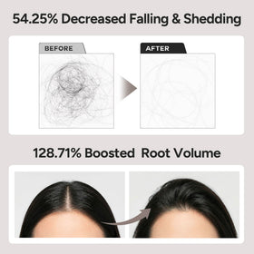 BANANAL applying roll-on to thinning crown to target scalp with concentrated actives