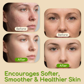 BanDolerA applied to hand showcasing hydration and non-greasy finish