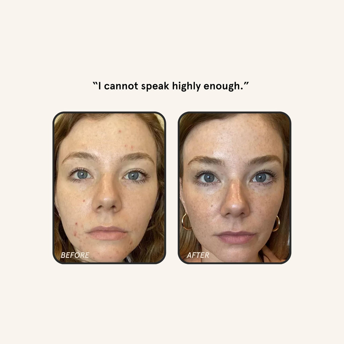 Barefaced hand applying serum to cheek demonstrating easy nightly use