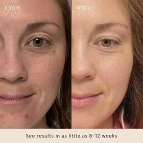 Barefaced drop of serum on hand demonstrating quick absorption benefit