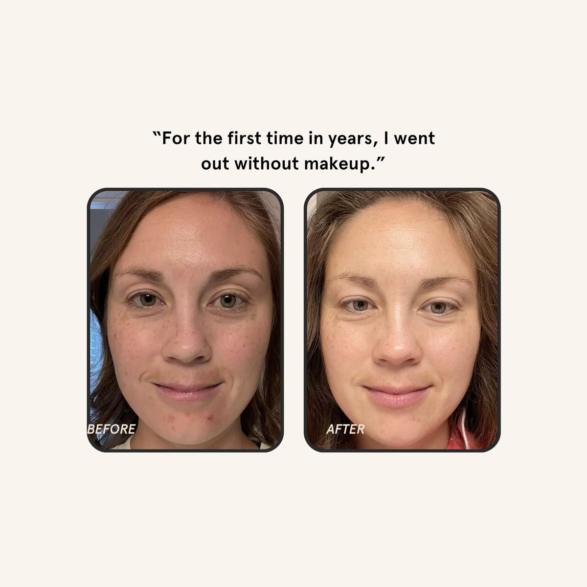 Barefaced 1 oz bottle with scale for size and travel-friendly benefit