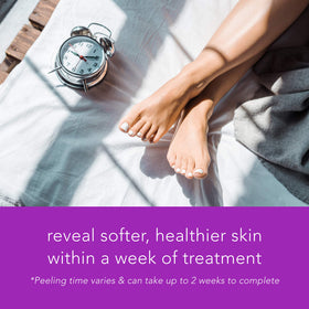Barefoot Scientist smooth feet after peel showing softer skin and renewed texture benefit