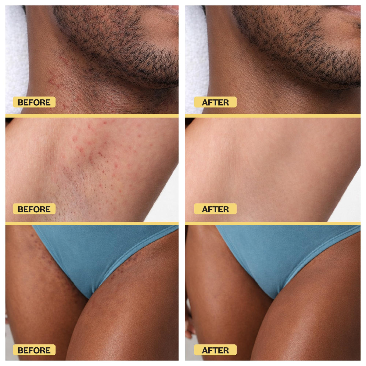 BASE LABORATORIES beard treatment demonstration softening coarse hair for smoother regrowth