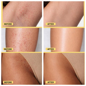 BASE LABORATORIES pad applied to underarm to soothe redness and improve texture