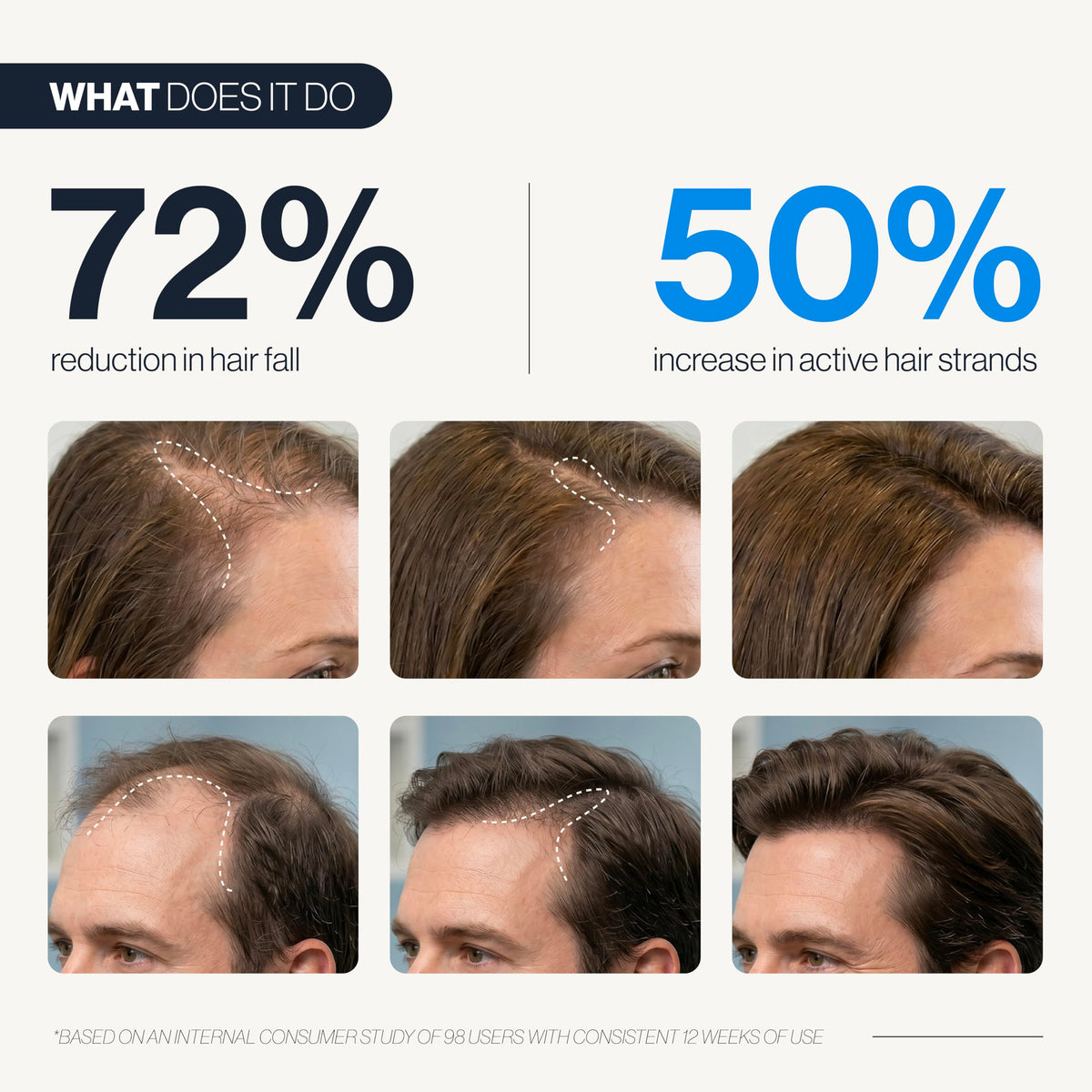 Be Bodywise roll-on applicator close-up for precise targeted delivery benefit