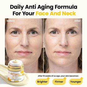 Bealions applied to neck and jawline for targeted firming and smoothing