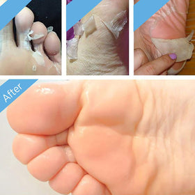 Bealuz peeling progress on heels showing removal of dead skin and softer feet