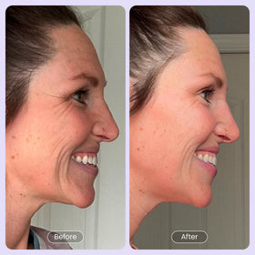 Beautiste serum on bathroom vanity in lifestyle scene showing daily routine benefit