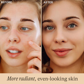 Beauty by Earth pipette dispensing serum demonstrating precise application