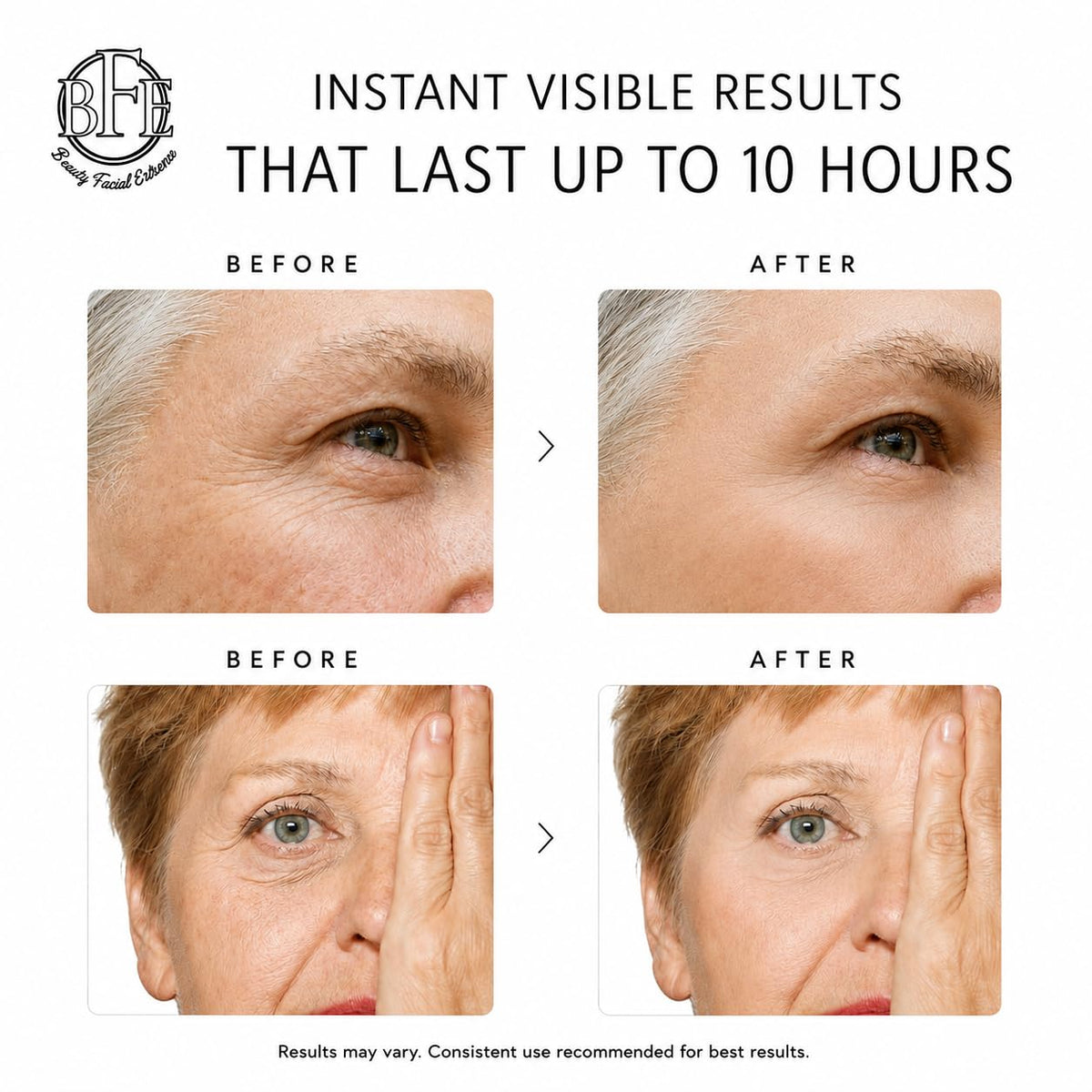 Beauty Facial Extreme before and after split-screen showing reduced puffiness