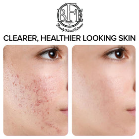 Beauty Facial Extreme pad being wiped on neck and jawline during routine