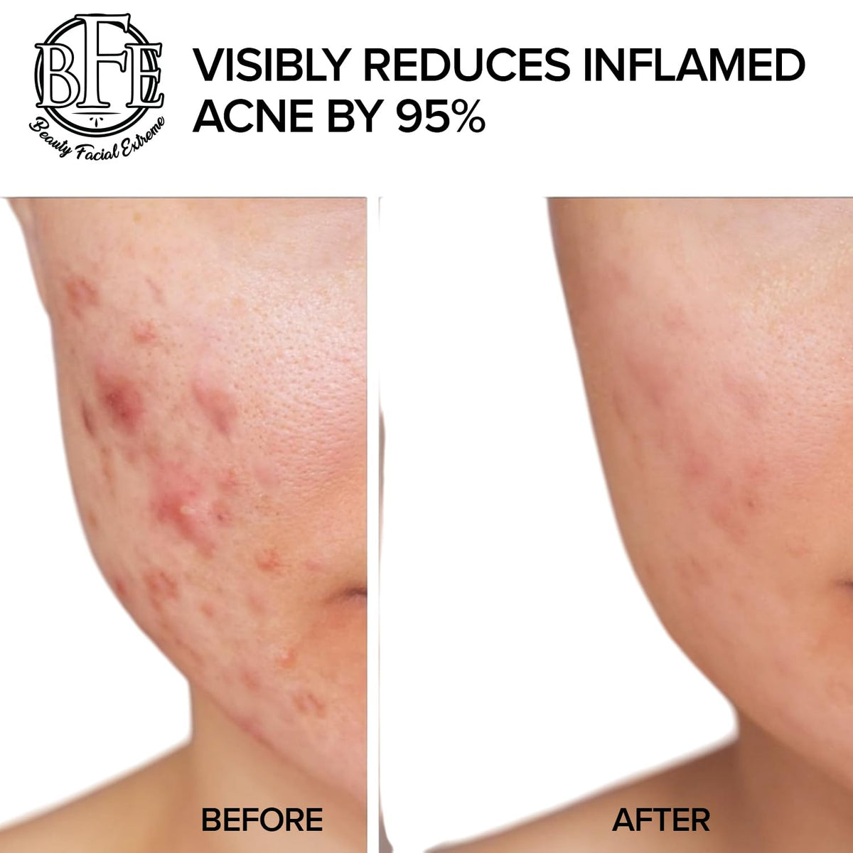 Beauty Facial Extreme ingredients label close-up showing acid blend benefits