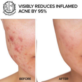 Beauty Facial Extreme ingredients label close-up showing acid blend benefits