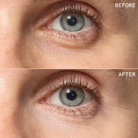 Beauty Pie before and after closeup showing brighter under-eye appearance