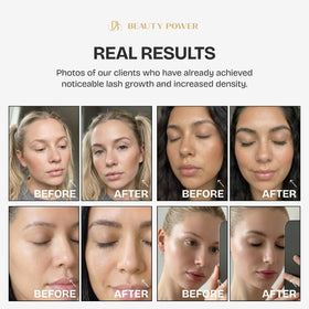 Beauty Power precision click-pen button detail for controlled, mess-free dosing