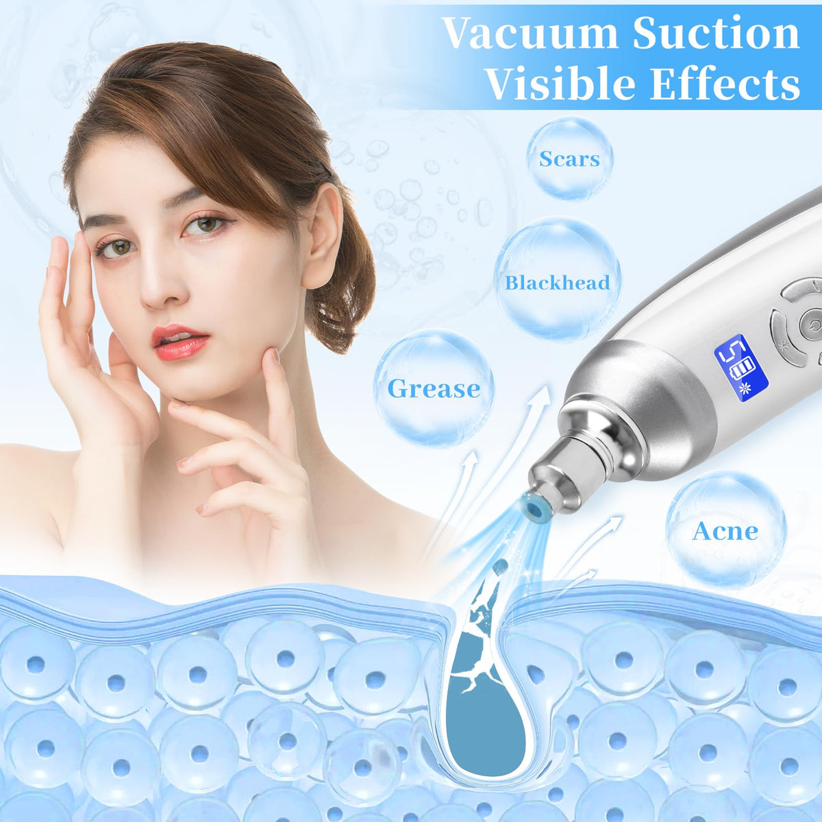 Beauty Star device extracting pore debris on nose showing clearer pores benefit