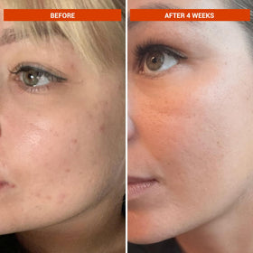 BeautyStat in bathroom routine with towel showing how it fits AM and PM skincare