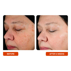 BeautyStat visual of peptides and vitamin C ingredients supporting firmness