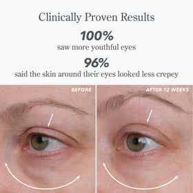 Beekman 1802 serum on fingertip illustrating lightweight absorption for lids