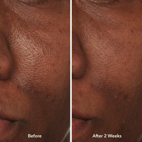 Beekman 1802 potato pulp ingredient visual highlighting natural brightening benefit