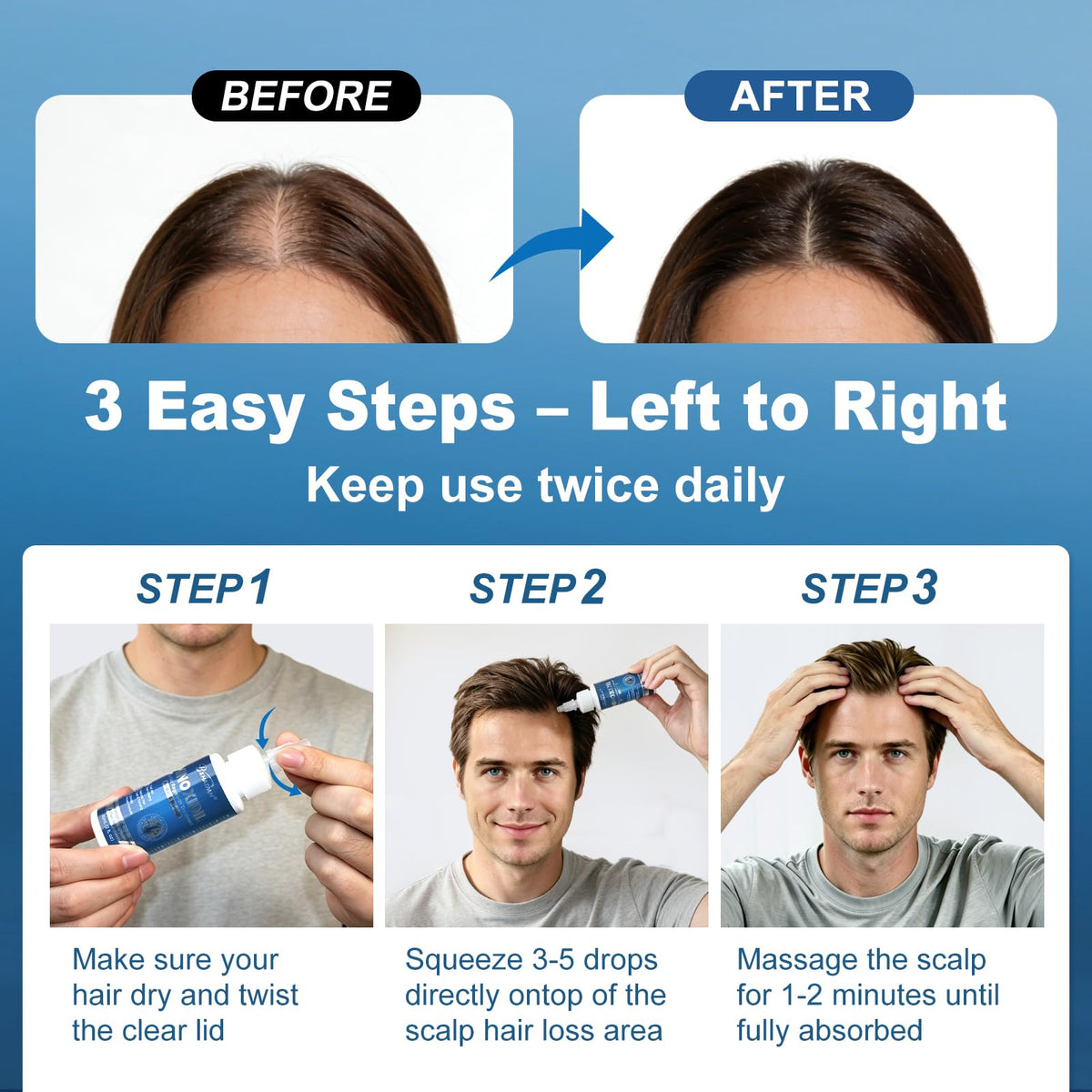 BEHATMH used on beard area showing controlled coverage and improvement